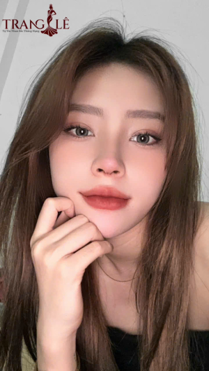 Nhấn mí mắt cười